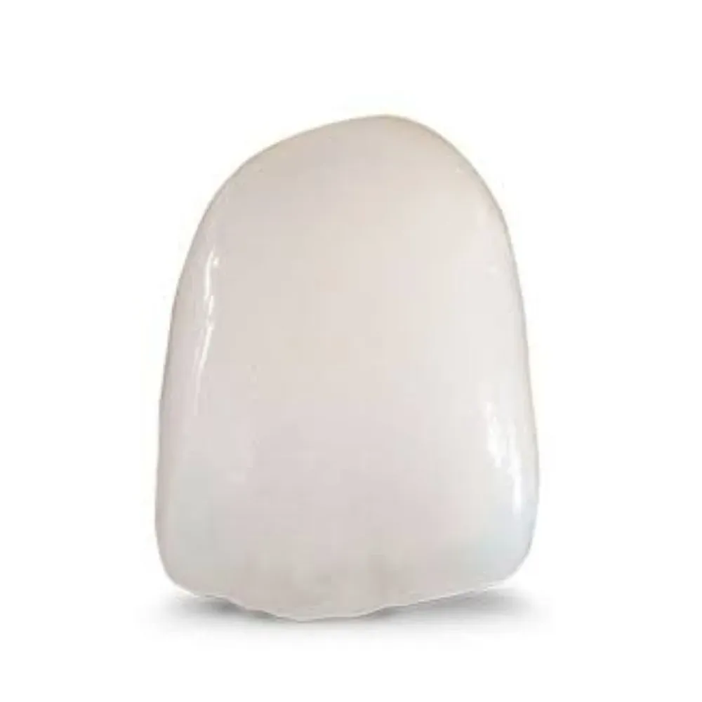 PFZ crown, zirconia core layered with porcelain