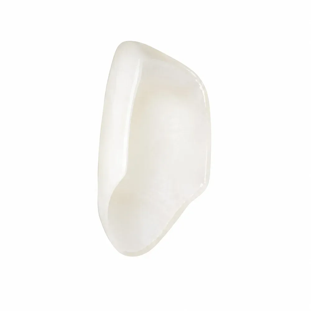 Layered feldspathic porcelain veneers on the refractory die
