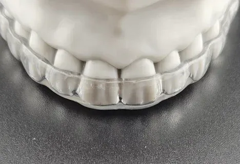 A clear CLEARsplint appliance held to the light beside a conventional hard splint