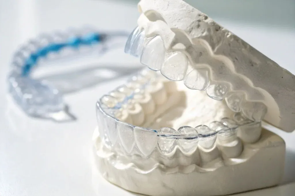 A staged digital aligner setup on screen, teeth moved to target