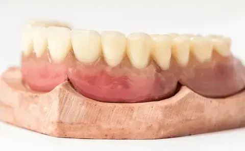 An immediate complete denture delivered on the surgical day