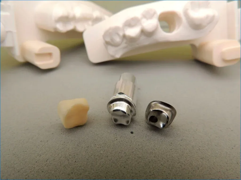 Custom titanium abutment shaped for emergence profile