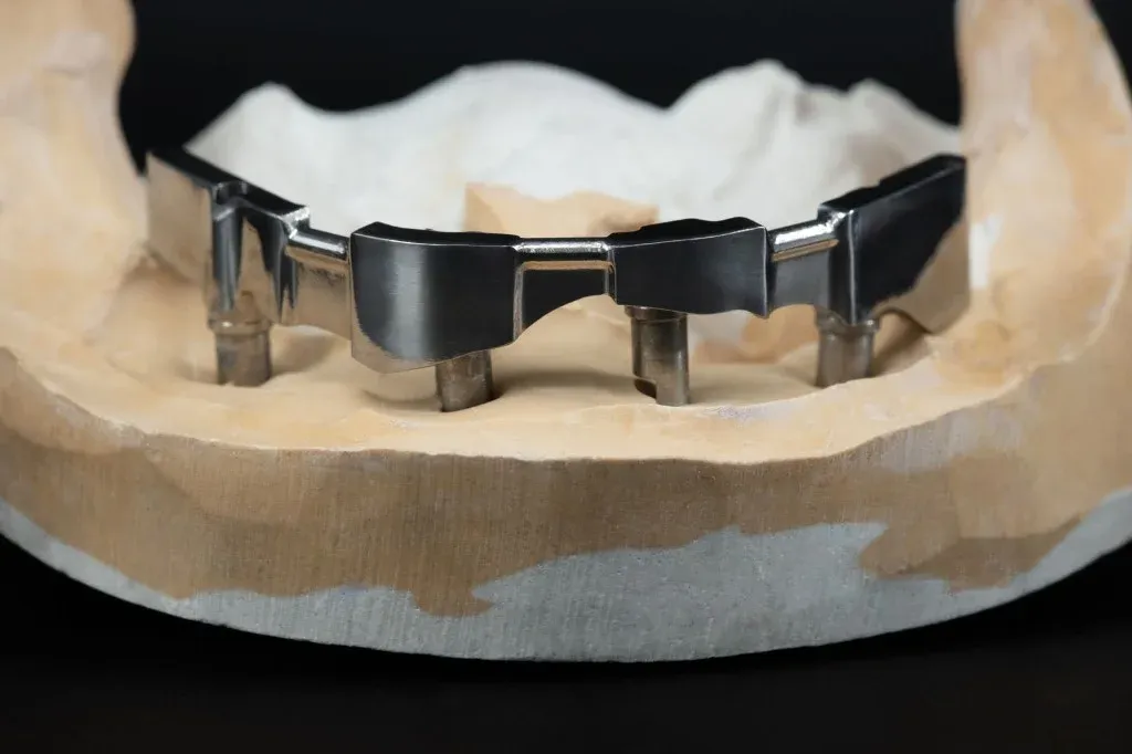 Milled titanium fixed implant bar on the master model