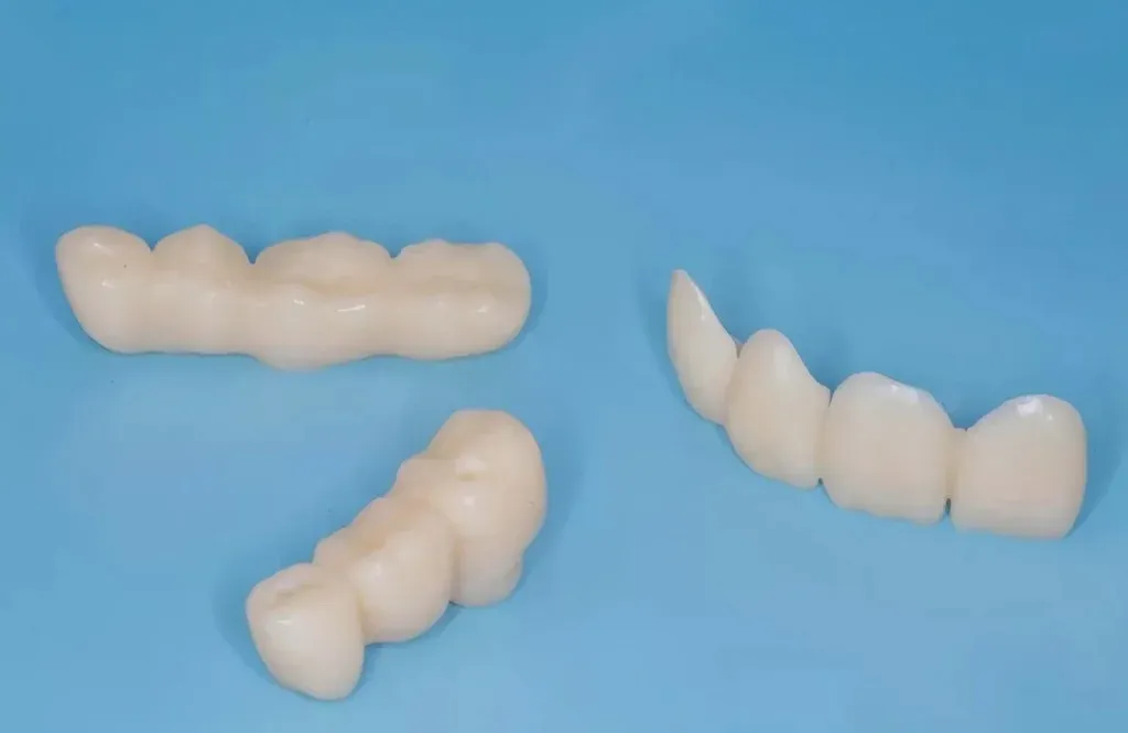 Monolithic zirconia bridge milled from a pre-sintered blank