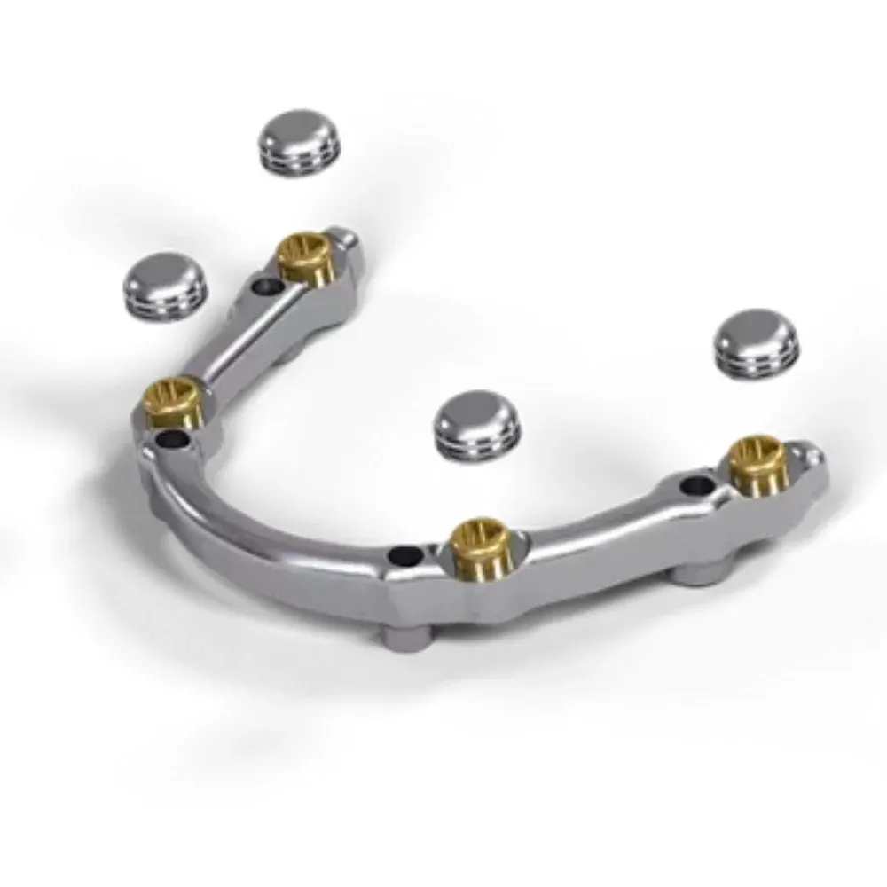 Screw-retained zirconia crown on a titanium base, access channel open