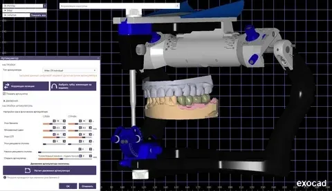 Technician designing a digital wax-up in CAD, proposed restorations on screen against the occlusion