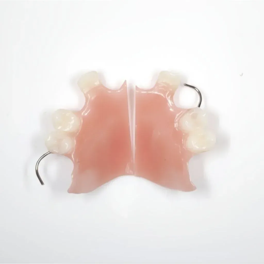 Technician seating denture fracture fragments together on the bench to check alignment before repair