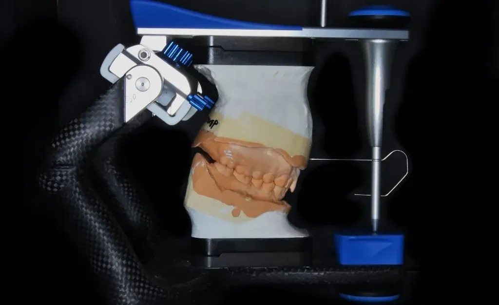 A milled PMMA provisional checked for margin and occlusion on the articulated model