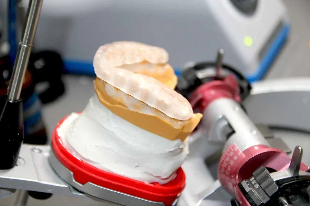 A trimmed laminate on the articulator, occlusion being refined against the opposing model