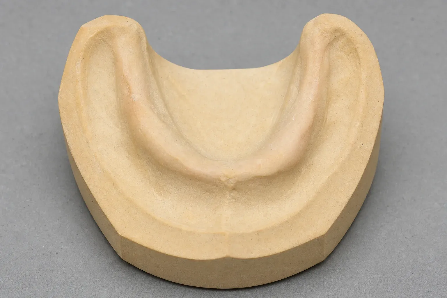A working cast with extraction teeth removed and the ridge contoured
