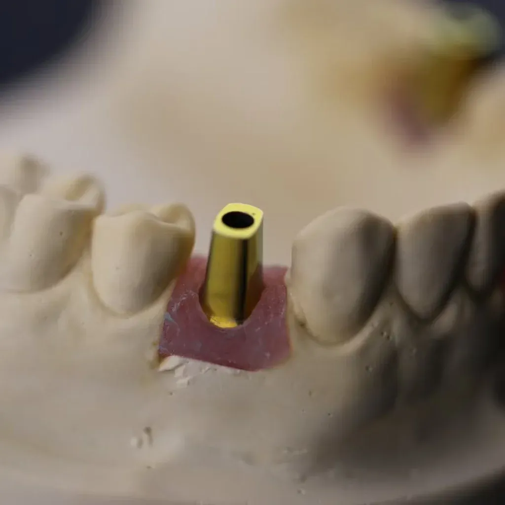 Custom abutment seated on the implant analog for a fit check