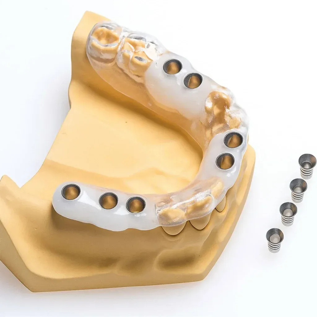 Finished printed surgical guide with metal sleeves seated on the model