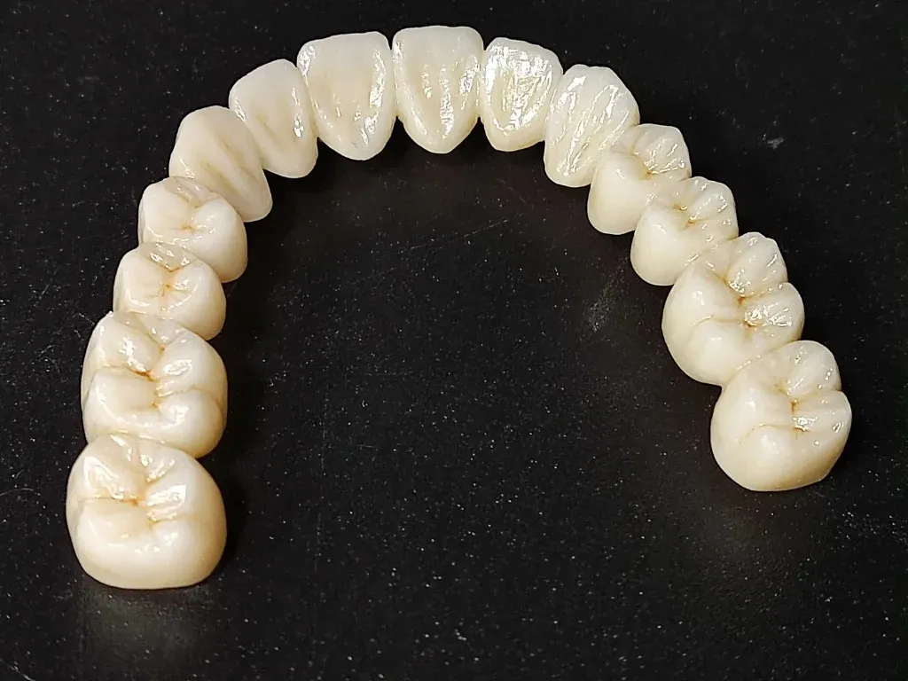 Long-span milled zirconia bridge held to the light as a single piece of material