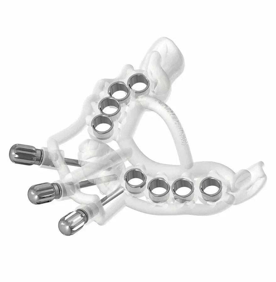 Printed bone reduction guide with fixation pins beside the model it was planned on