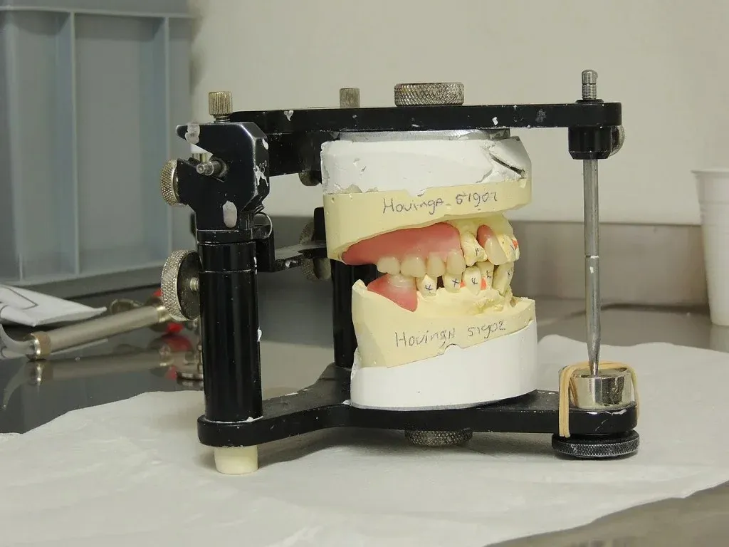 Relined denture on the articulator with occlusion being verified against the opposing cast