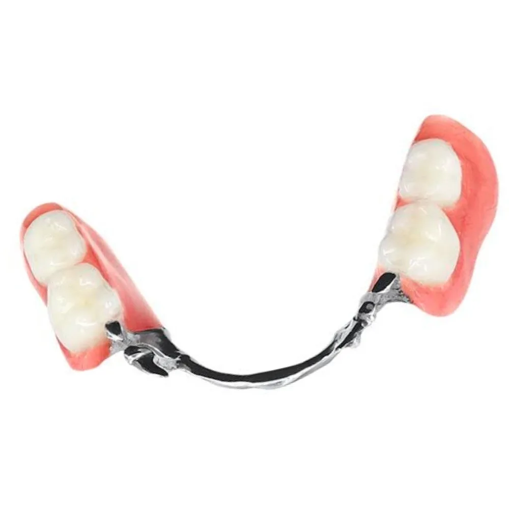 Cast metal partial denture framework