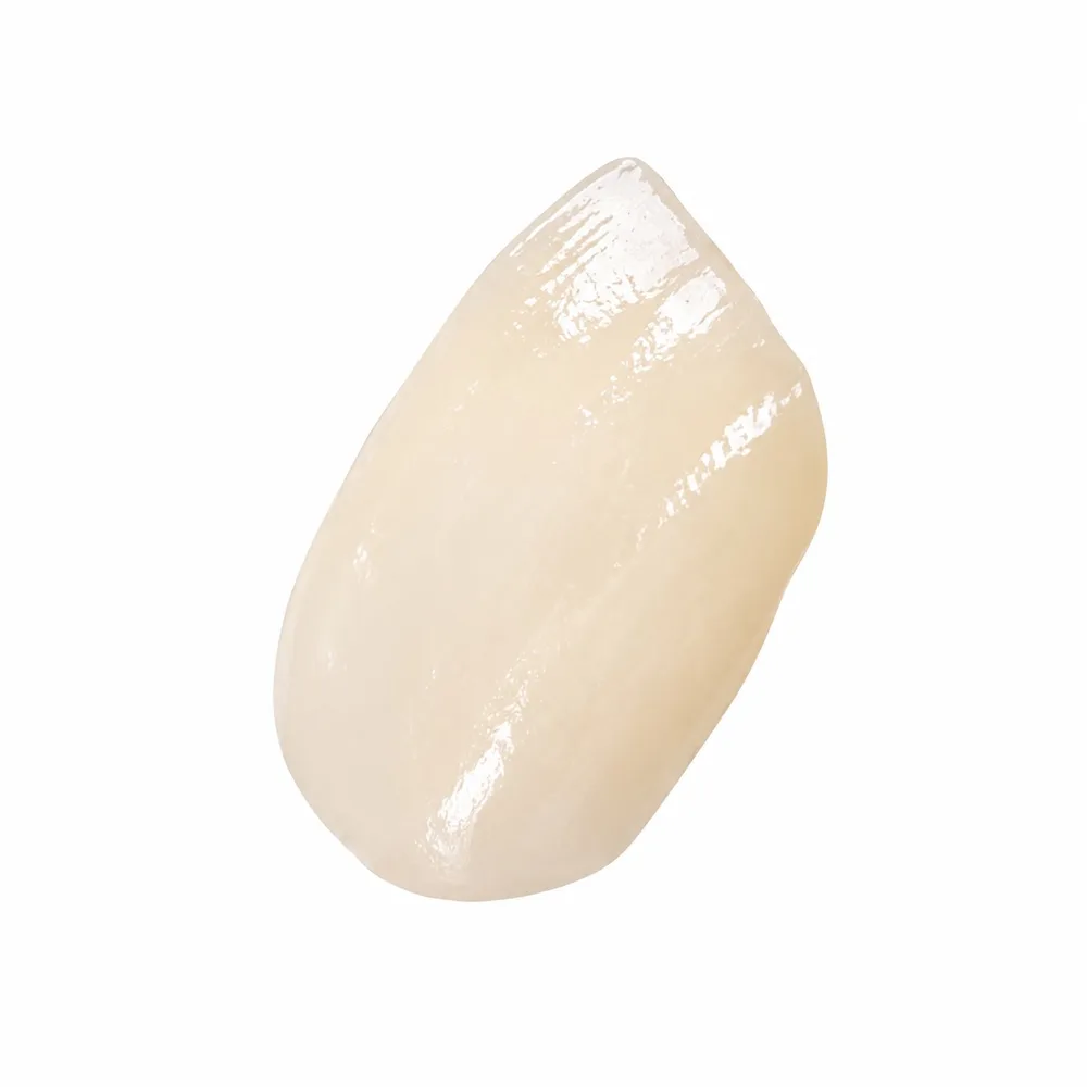 Lab-fabricated composite veneers